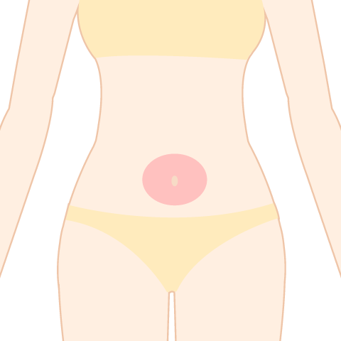医療脱毛 へそ周り