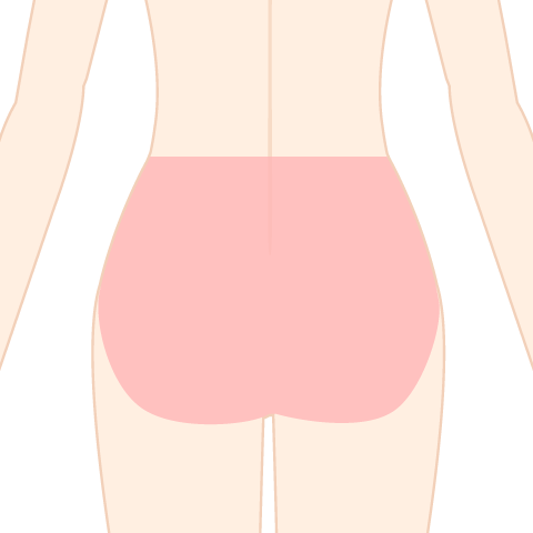 医療脱毛 ヒップ