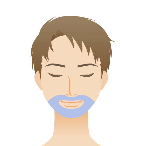 医療脱毛 男性 ひげ